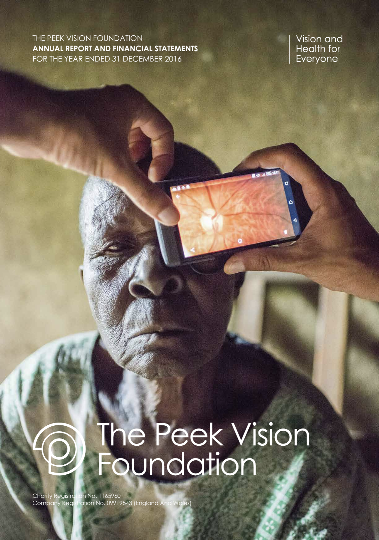 A hand holds a camera up to an elderly woman's face as she has her eyes tested using the (now discontinued) Peek Retina tool - a device which allows you to see the back of the eye. In front it reads The Peek Vision Foundation, Annual Report 2016.