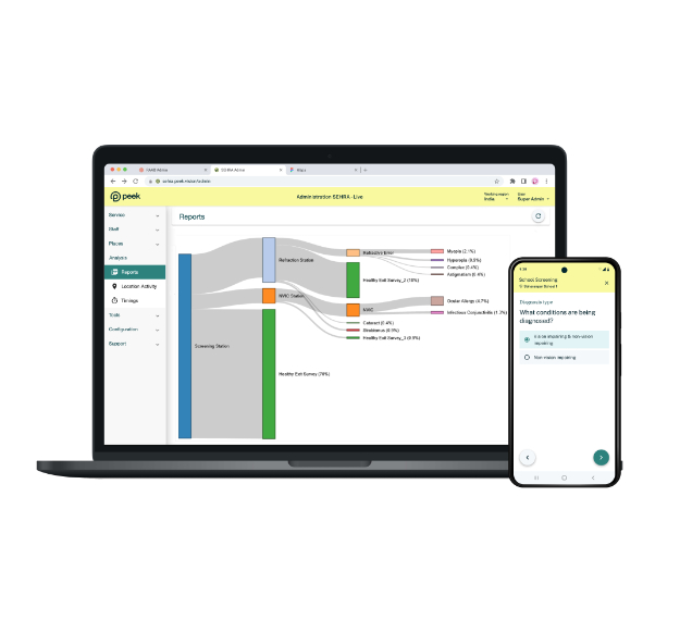 A laptop and phone screen showing the Peek school eye health rapid assessment tool
